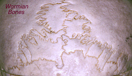 antro5