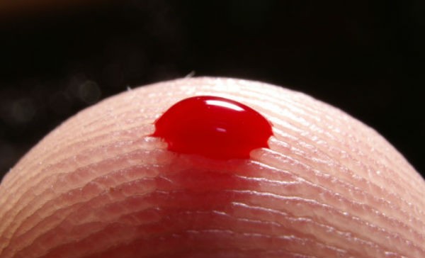 cancer de sangre tipos y sintomas 123