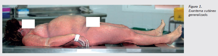 caso fig1