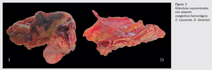 caso fig3