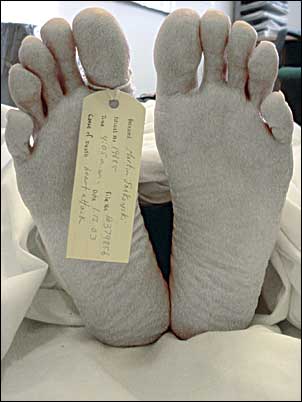0303ib_cadaver